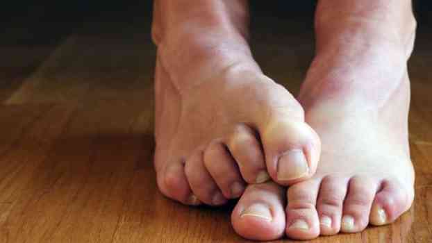 Identify Lung Cancer With the Help of Your Toe nails