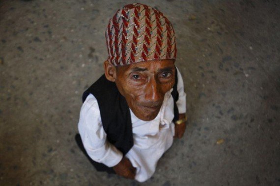 56 cm High, 72 Years Old Man Hot in Nepal