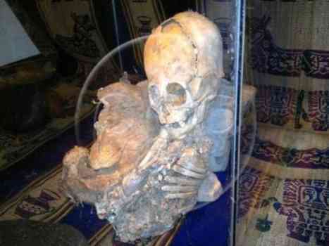 Bones of Alien with Strangely Shaped Head Found in Peru!-1