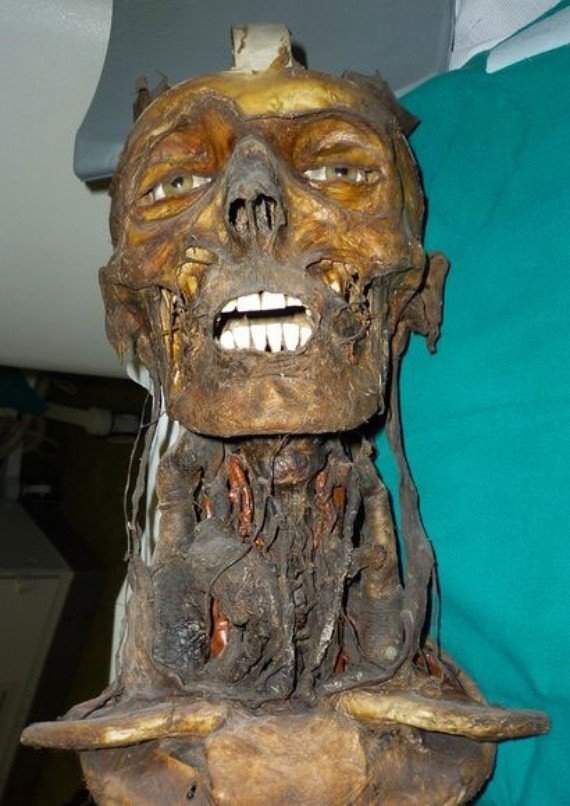 The Secret Inside the Skull of the 19th Century Mummy -4