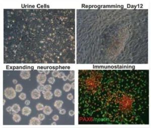 Neurons are Obtained from Urine by Cell Reprogramming 1