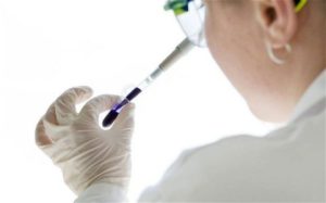 Blood Test can Predict the Risk of Death in the Next Five Years 1